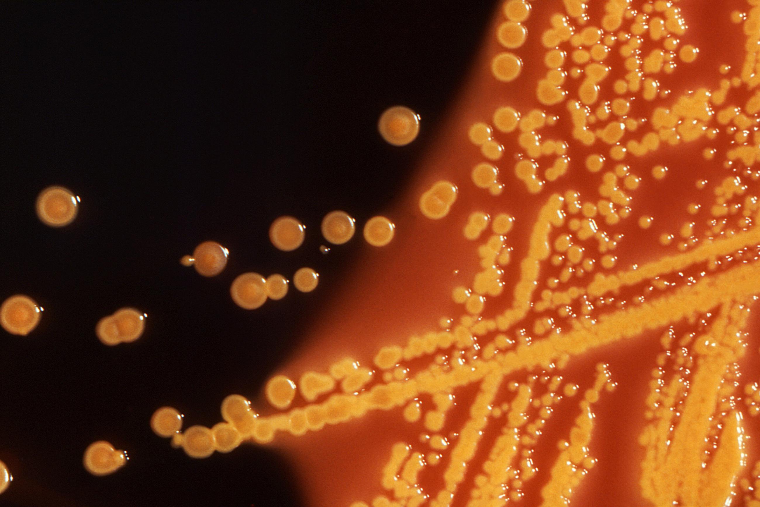 Colonies of E. coli bacteria grown on a Hektoen enteric (HE) agar plate as seen under a microscope.